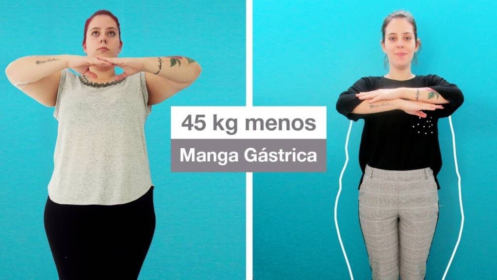 manga gastrica