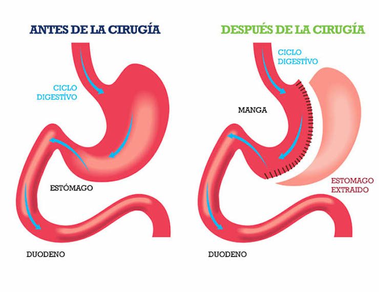 manga gastrica
